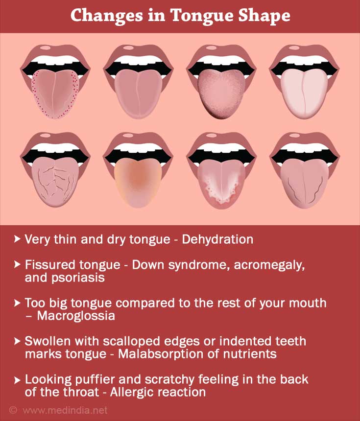 Changes in Tongue Shape