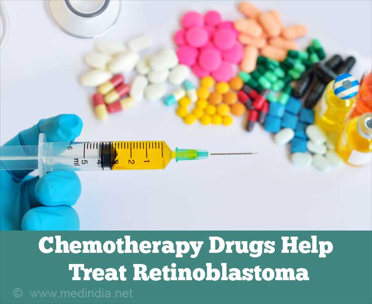 Chemotherapy Drugs Helps Treat Retinoblastoma