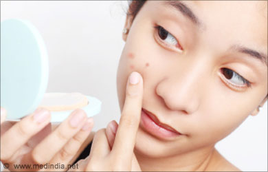 Coconut Water as a Skin Tonic: Pimples Coconut Water as a Skin Tonic: Pimples