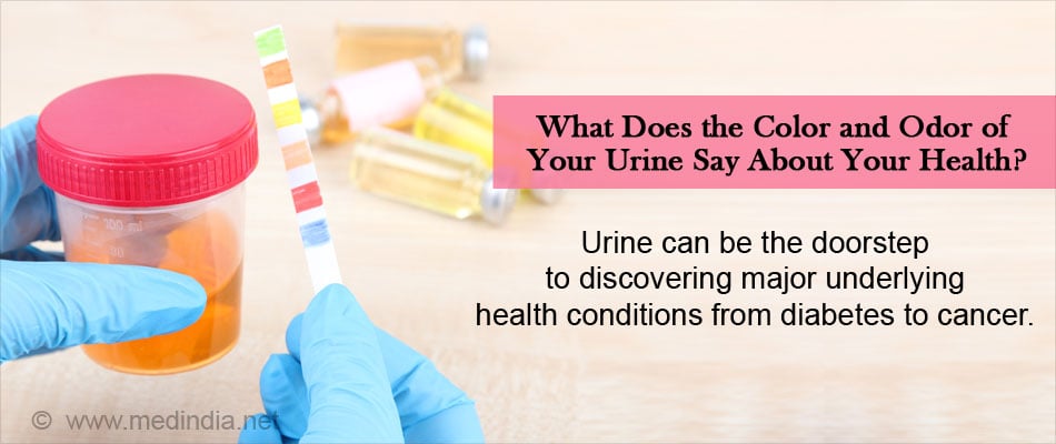 Urine Odor Chart