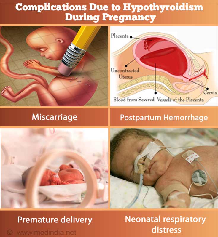 hypothyroidism-during-pregnancy-causes-symptoms-complications