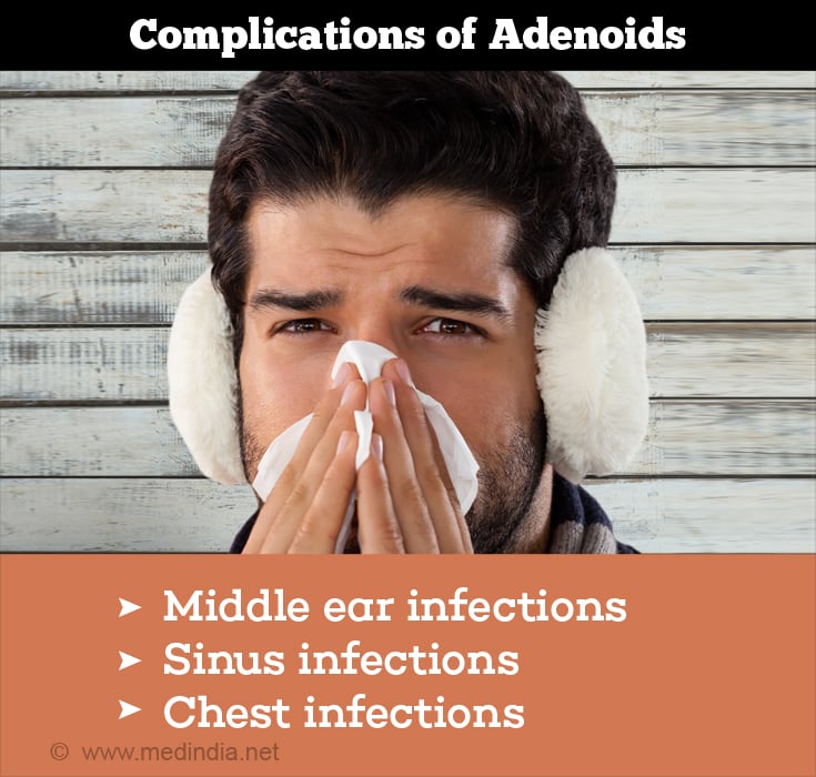 Adenoids Symptoms