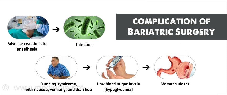 bariatric surgery complications