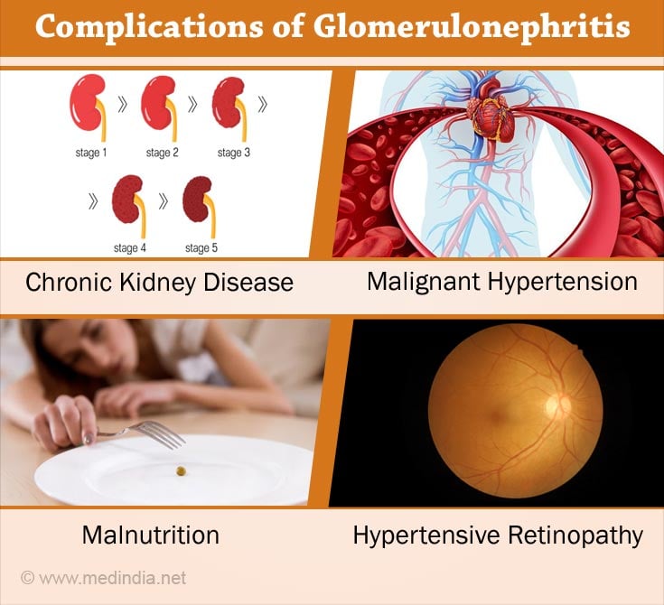 Complications of Glomerulonephritis