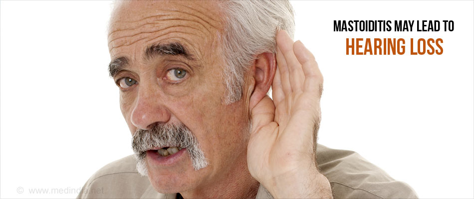 Complications of Mastoiditis – Hearing Loss Complications of Mastoiditis – Hearing Loss
