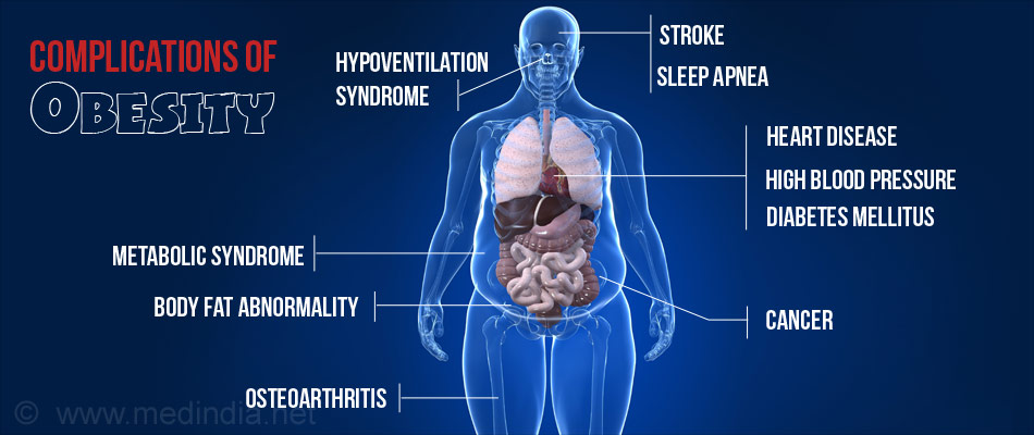 Complications of Obesity Complications of Obesity