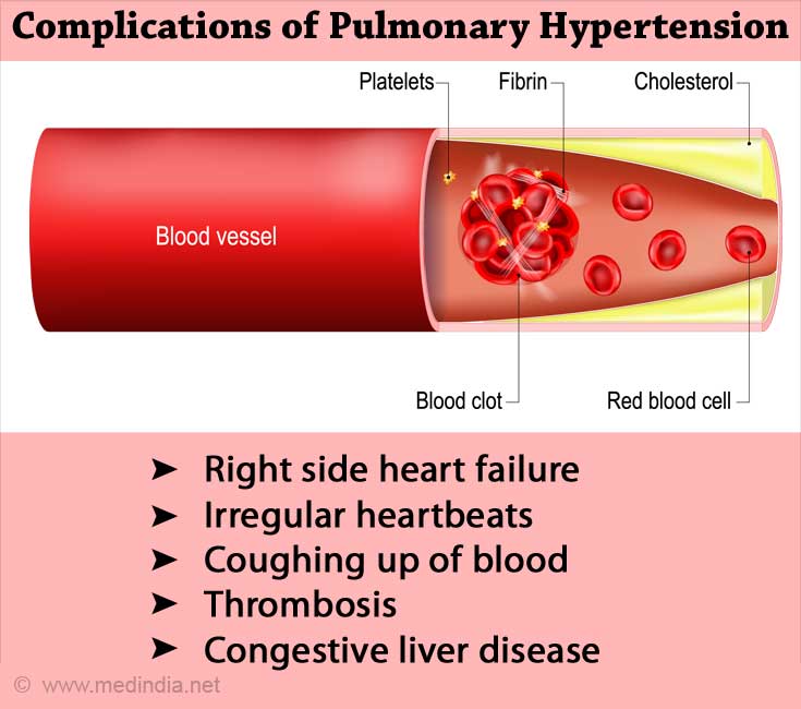 complications-of-hypertension