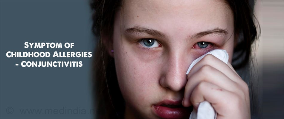 Symptom of Childhood Allergies - Conjunctivitis Symptom of Childhood Allergies - Conjunctivitis
