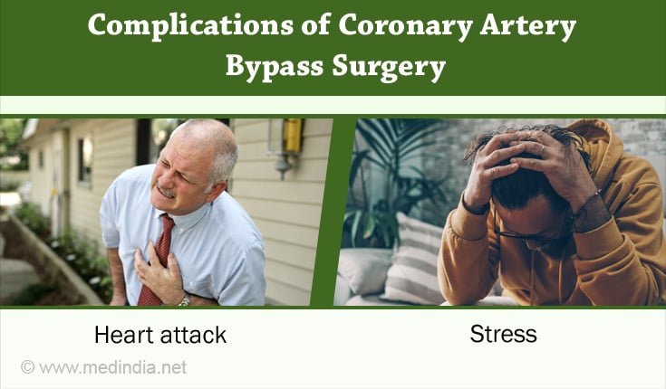 Coronary Artery Bypass Grafting Prognosis
