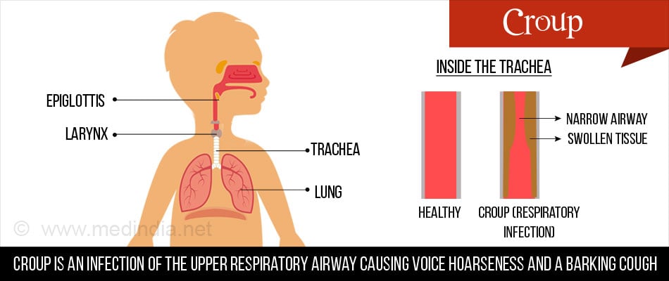 croup lung sounds
