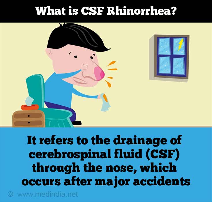 Nasal Discharge – Symptom Evaluation