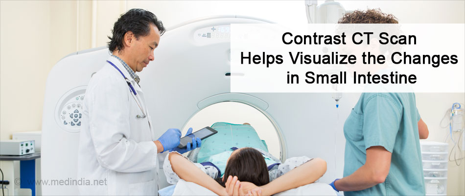 Contrast CT Scan Helps Visualize the Changes in Small Intestine