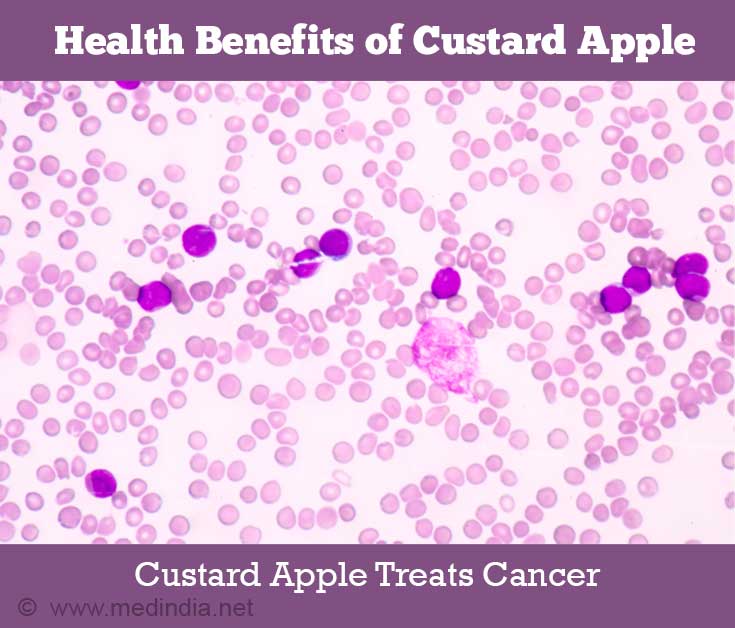 Custard Apple to Treat Cancer Custard Apple to Treat Cancer