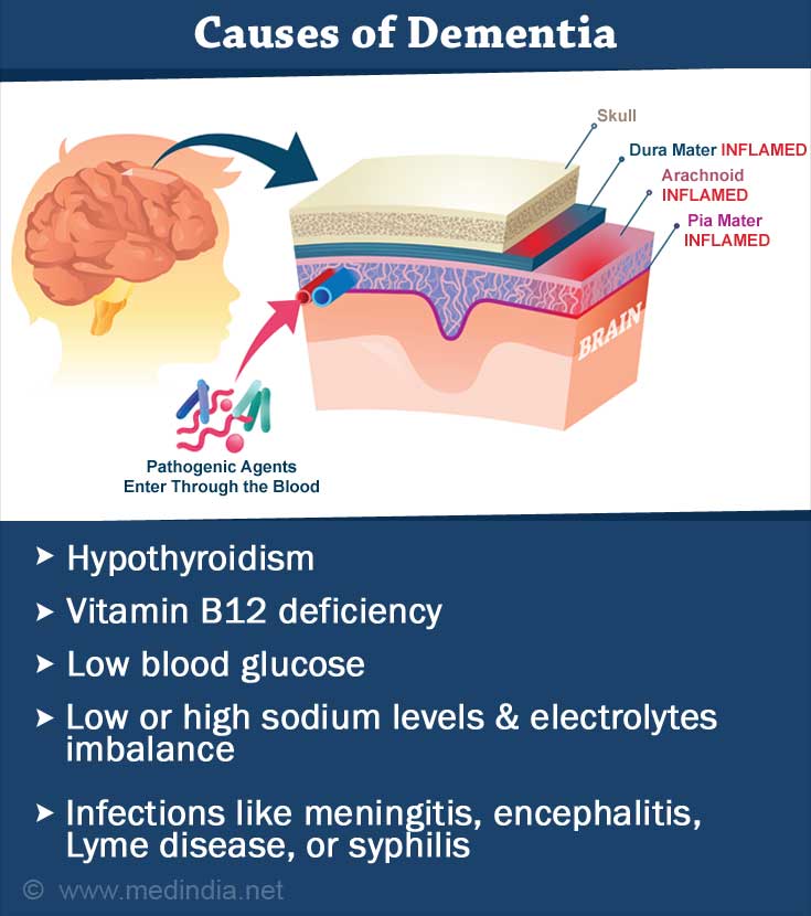 Causes of Dementia Causes of Dementia