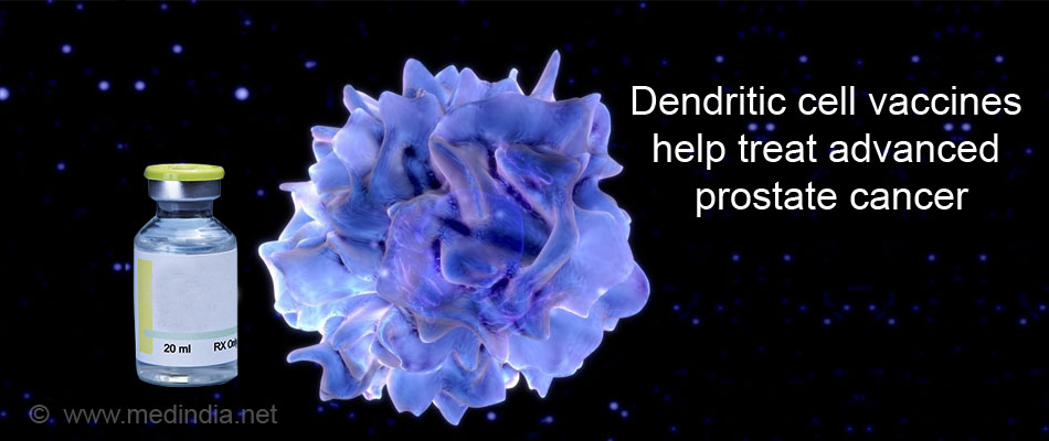 Dendritic Cell Vaccines Helps Treat Advanced Prostate Cancer Dendritic Cell Vaccines Helps Treat Advanced Prostate Cancer