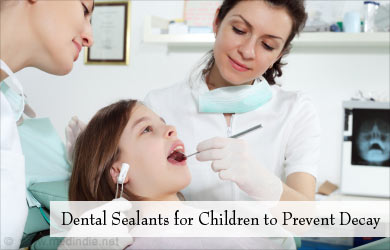 Dental Sealants for Children Dental Sealants for Children