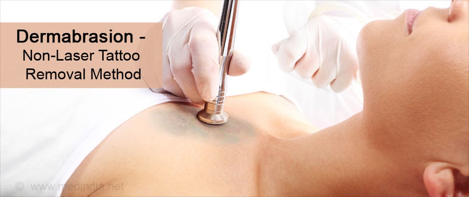 Your Complete Guide to Tattoo Removal  Allure