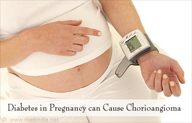 Causes of Chorioangioma - Diabetic Mother Causes of Chorioangioma - Diabetic Mother