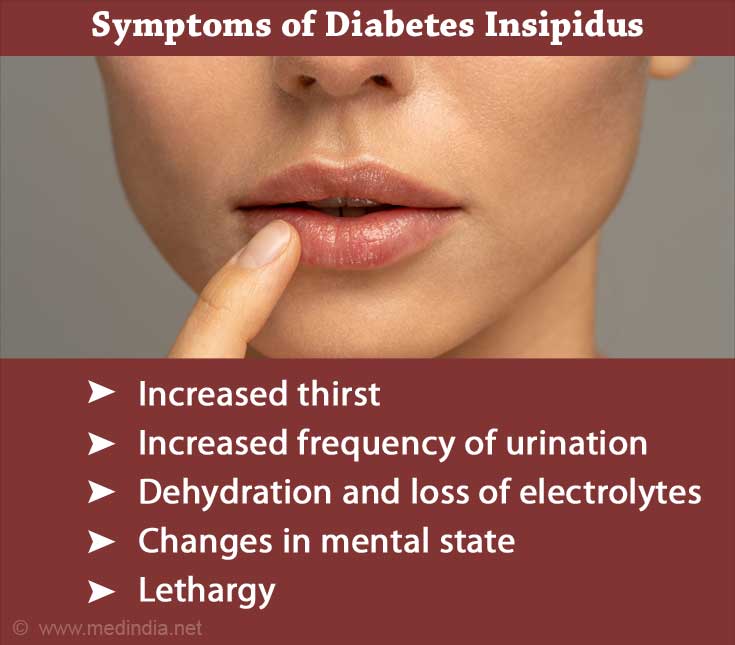 Diabetes Insipidus Causes Symptoms Diagnosis Treatment Complications