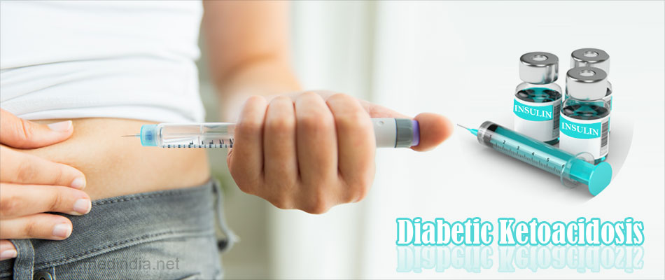 Diabetic Ketoacidosis (DKA) Diabetic Ketoacidosis (DKA)