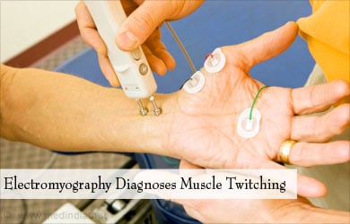 Diagnosis of Muscle Twitching - Electromyography Diagnosis of Muscle Twitching - Electromyography