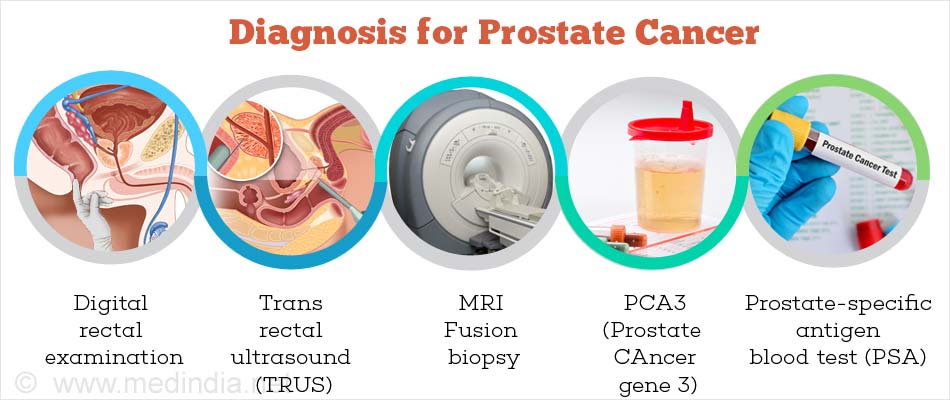 prostate cancer symptoms tests and treatment