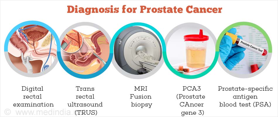 prostate cancer blood test)