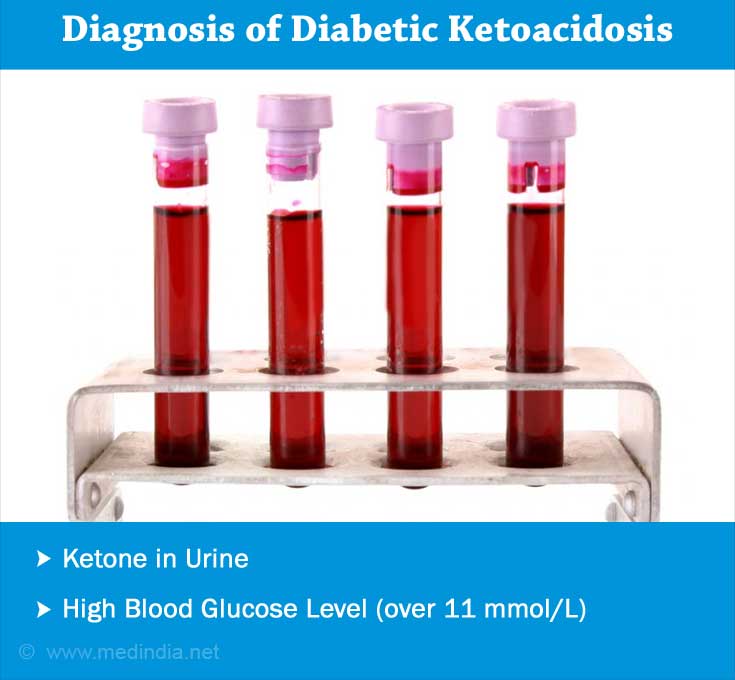 Diabetic Ketoacidosis - Causes, Symptoms, Complications, Diagnosis ...