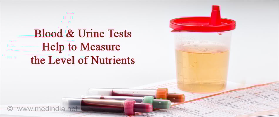 Blood & Urine Tests Helps to Measure the Level of Nutrients Blood & Urine Tests Helps to Measure the Level of Nutrients