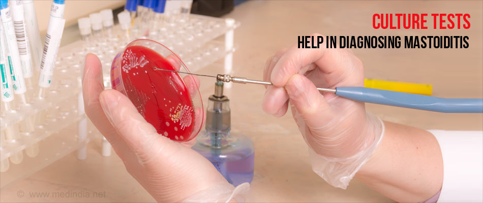 Diagnosis Of Mastoiditis - Culture Testing Diagnosis Of Mastoiditis - Culture Testing