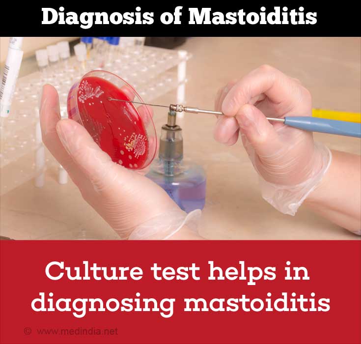 Mastoiditis Causes Symptoms Diagnosis Complications And Treatment 7463