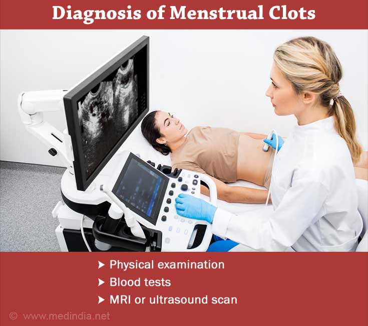 Is it Normal to have Blood Clots during Menstruation?