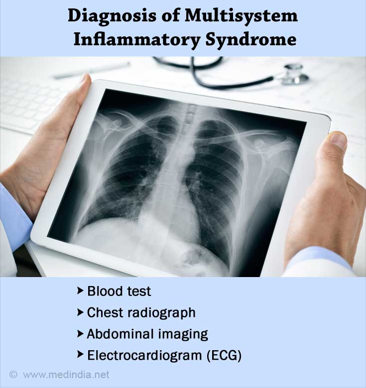 Multisystem Inflammatory Syndrome (MIS-C)