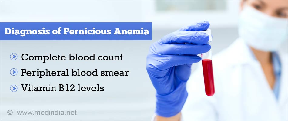 Pernicious Anemia Causes Symptoms Risk Factors Diagnosis Treatment And Complications 0880