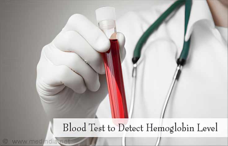 Diagnosis of Postpartum Hemorrhage - Blood Test Diagnosis of Postpartum Hemorrhage - Blood Test