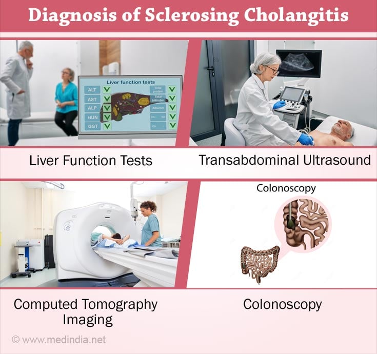 Diagnosis of Sclerosing Cholangitis