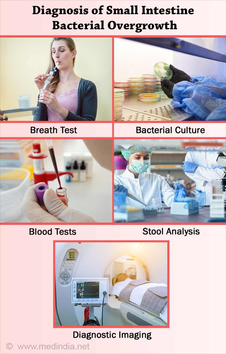 Diagnosis of Small Intestine Bacterial Overgrowth Diagnosis of Small Intestine Bacterial Overgrowth