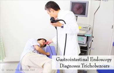 Diagnosis of Trichobezoars - Gastrointestinal Endoscopy Diagnosis of Trichobezoars - Gastrointestinal Endoscopy