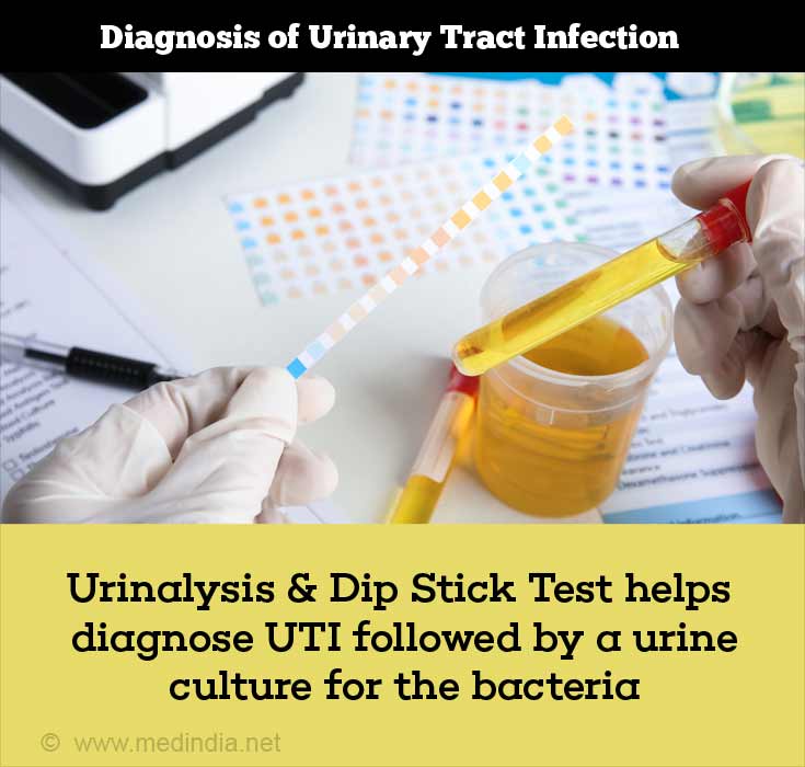 How can we Diagnose Urinary Tract Infection (UTI)?