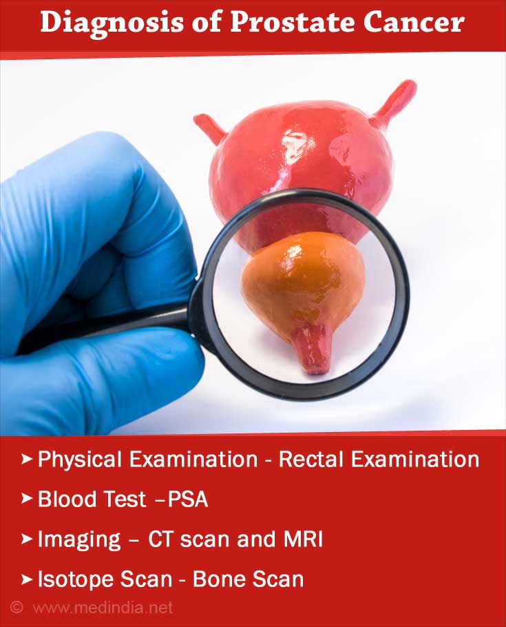 download prostate cancer diagnosis