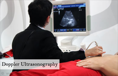 Doppler Ultrasonography Doppler Ultrasonography