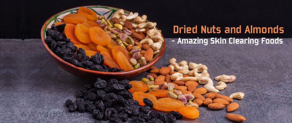 Dried Nuts and Almonds - Amazing Skin Clearing Foods Dried Nuts and Almonds - Amazing Skin Clearing Foods