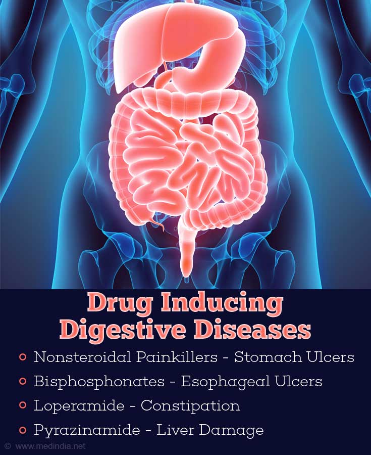 Drug Inducing Digestive Diseases Drug Inducing Digestive Diseases
