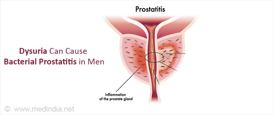 Dysuria, Painful Micturition