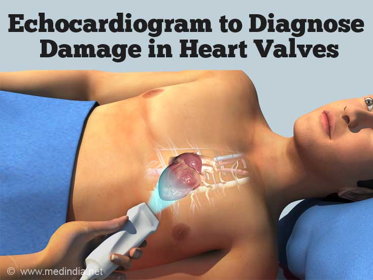 Echocardiogram for Abnormal Heart Rhythm Echocardiogram for Abnormal Heart Rhythm