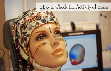 EEG to Diagnose Fas EEG to Diagnose Fas