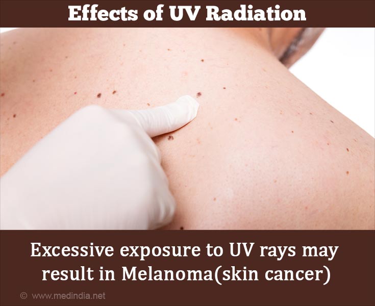 UV radiation and skin cancer