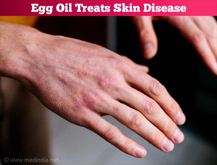 Health Benefits of Egg Oil