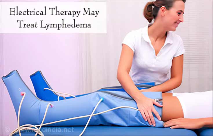 Electrical Therapy for Treatment of Lymphedema Electrical Therapy for Treatment of Lymphedema