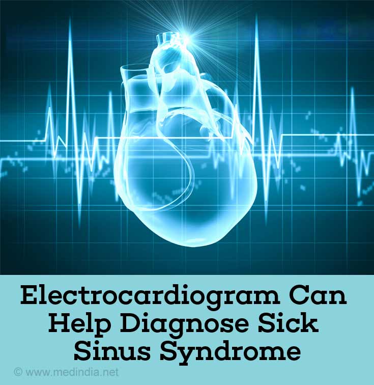 Sick Sinus Syndrome - Causes, Symptoms, Diagnosis, Treatment & Prevention